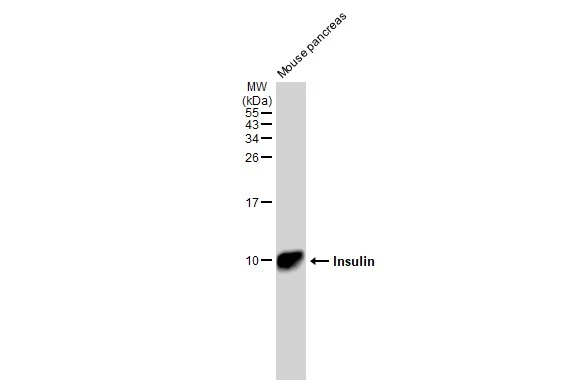 Mouse tissue extract (50 μg) was separated by 15% SDS-PAGE, and the membrane was blotted with Insulin antibody [GT1229] (GTX02826) diluted at 1:1000. The HRP-conjugated anti-rabbit IgG antibody (GTX213110-01) was used to detect the primary antibody.