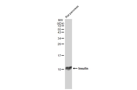 Rat tissue extract (50 microg) was separated by 15% SDS-PAGE, and the membrane was blotted with Insulin antibody [GT1229] (GTX02826) diluted at 1:1000. The HRP-conjugated anti-rabbit IgG antibody (GTX213110-01) was used to detect the primary antibody.