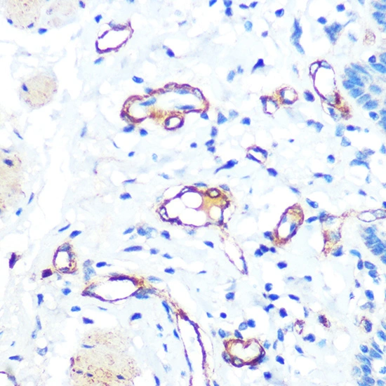 IHC-P analysis of human esophageal tissue section using GTX02827 VWF antibody [GT1230]. Dilution : 1:100