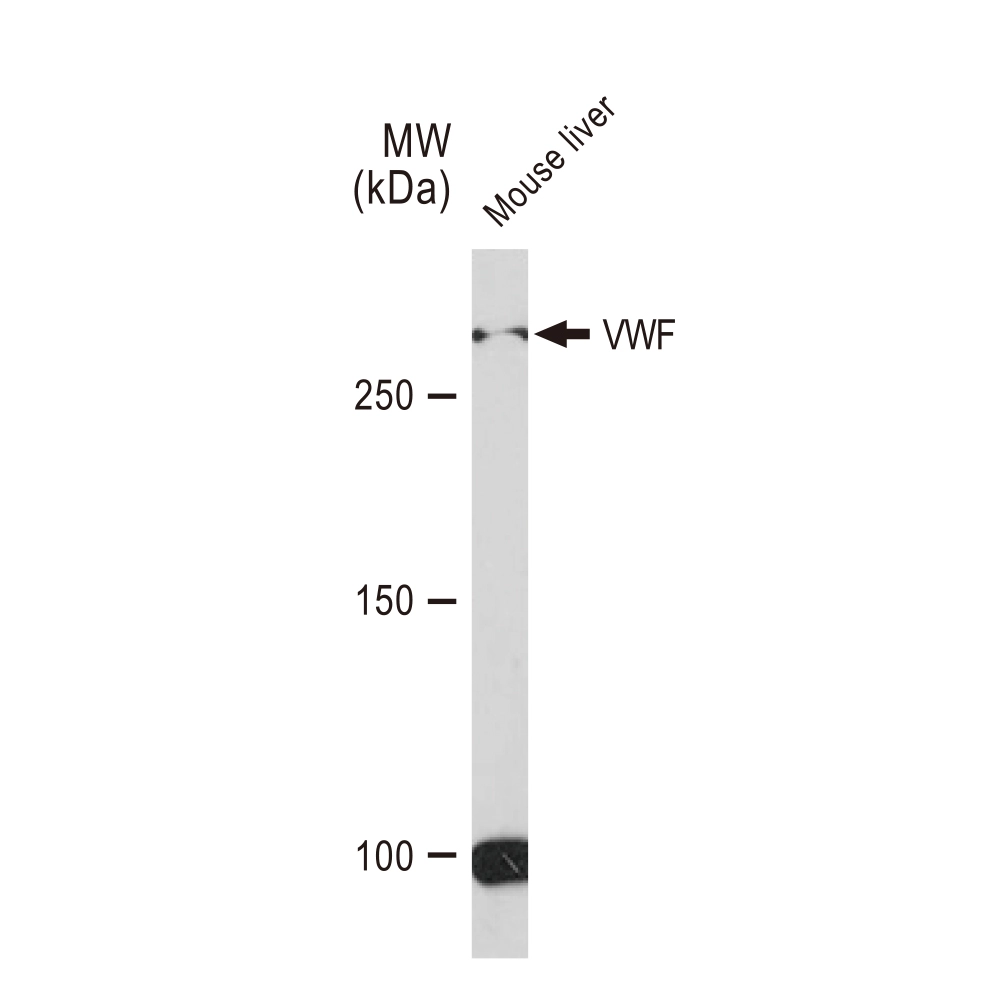 WB analysis of mouse liver tissue lysates using GTX02827 VWF antibody [GT1230]. Dilution : 1:1000 Loading : 25microg