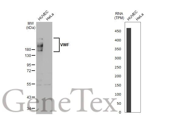 Various whole cell extracts (30 microg) were separated by 5% SDS-PAGE, and the membrane was blotted with VWF antibody [GT1230] (GTX02827) diluted at 1:1000. The HRP-conjugated anti-rabbit IgG antibody (GTX213110-01) was used to detect the primary antibody. Corresponding RNA expression data for the same cell lines are based on Human Protein Atlas program.