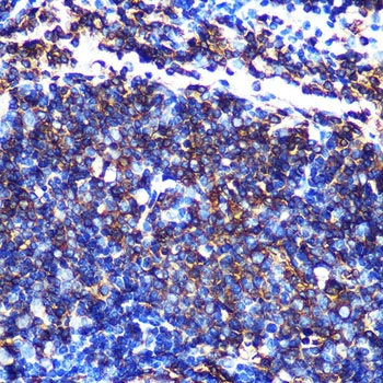 IHC-P analysis of mouse spleen tissue section using GTX02828 HLA-DQA1 antibody [GT1231]. Dilution : 1:100