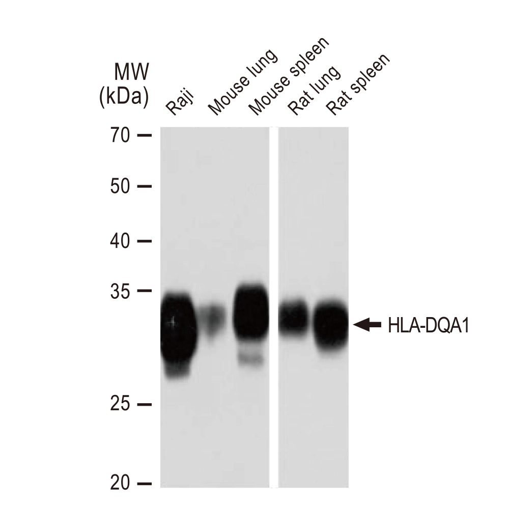 WB analysis of various samples using GTX02828 HLA-DQA1 antibody [GT1231]. Dilution : 1:1000 Loading : 25microg