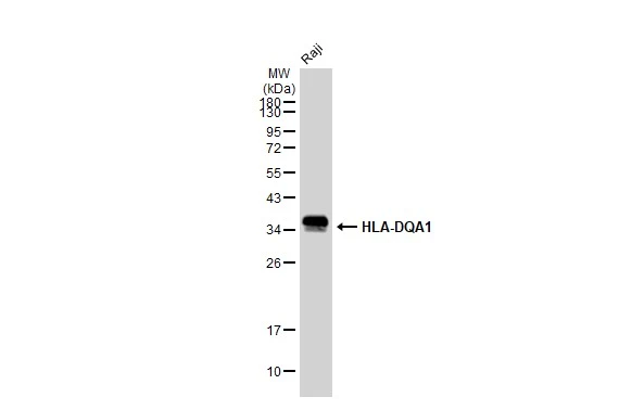 Whole cell extract (30 microg) was separated by 12% SDS-PAGE, and the membrane was blotted with HLA-DQA1 antibody [GT1231] (GTX02828) diluted at 1:1000. The HRP-conjugated anti-rabbit IgG antibody (GTX213110-01) was used to detect the primary antibody.