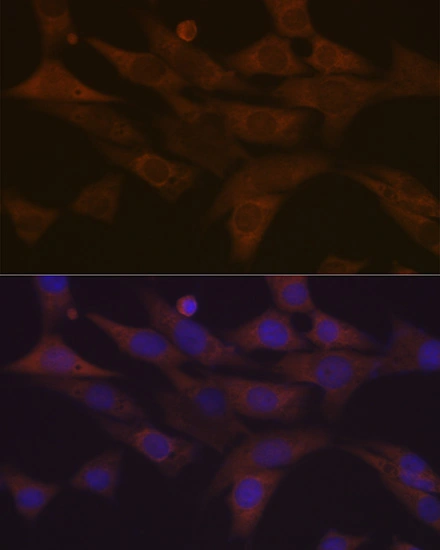 ICC/IF analysis of NIH-3T3 cells using GTX02829 PKC delta antibody [GT1232]. Dilution : 1:100 Blue : DAPI for nuclear staining.