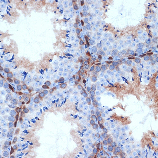 IHC-P analysis of mouse testis tissue section using GTX02829 PKC delta antibody [GT1232]. Dilution : 1:100
