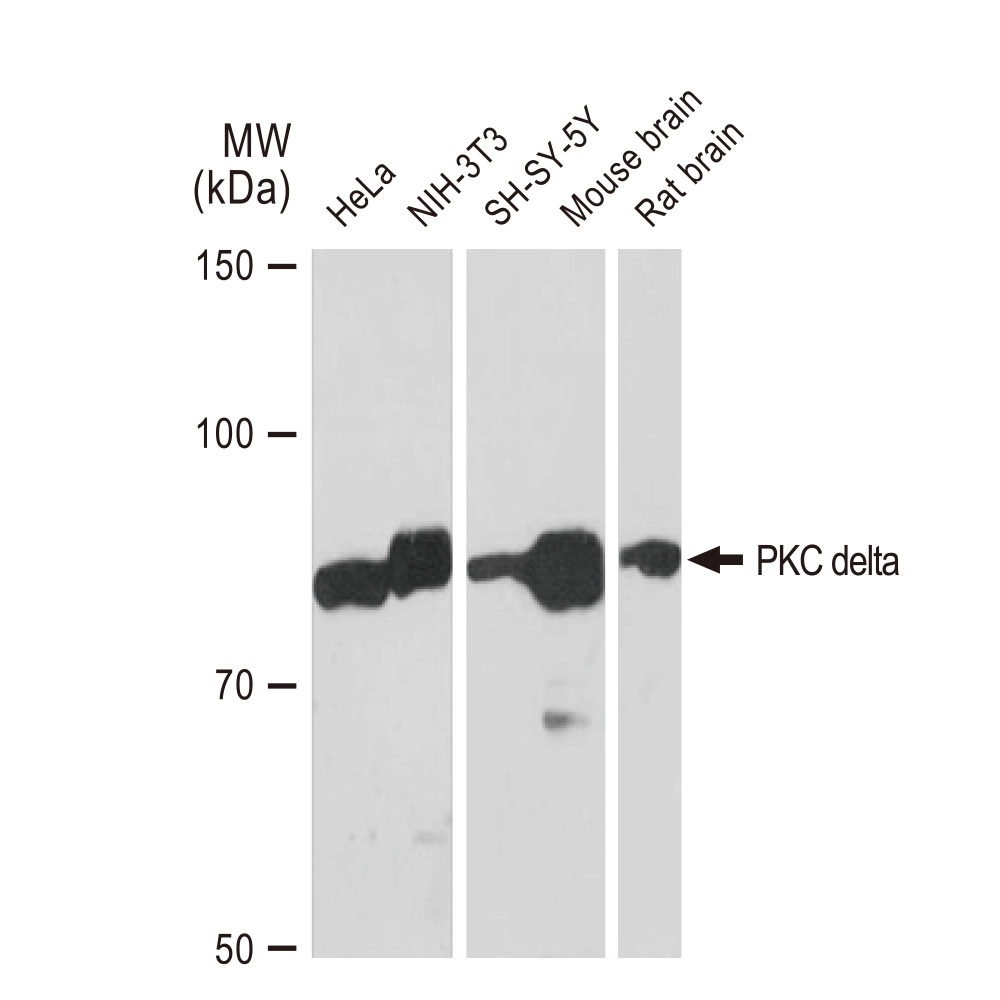 WB analysis of various samples using GTX02829 PKC delta antibody [GT1232]. Dilution : 1:1000 Loading : 25microg