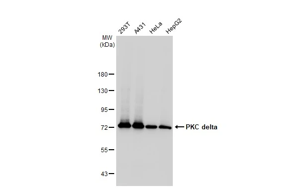 Various whole cell extracts (30 microg) were separated by 7.5% SDS-PAGE, and the membrane was blotted with PKC delta antibody [GT1232] (GTX02829) diluted at 1:1000. The HRP-conjugated anti-rabbit IgG antibody (GTX213110-01) was used to detect the primary antibody.