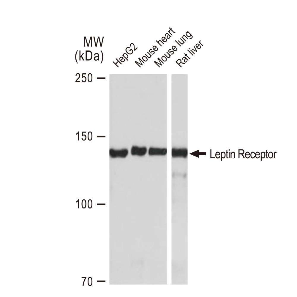 WB analysis of various samples using GTX02830 Leptin Receptor antibody [GT1233]. Dilution : 1:1000 Loading : 25microg