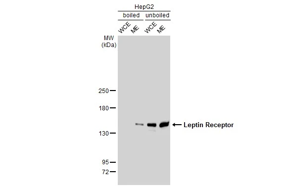 Boiled and unboiled HepG2 whole cell and membrane extracts (30 microg) were separated by 5% SDS-PAGE, and the membrane was blotted with Leptin Receptor antibody [GT1233] (GTX02830) diluted at 1:500. The HRP-conjugated anti-rabbit IgG antibody (GTX213110-01) was used to detect the primary antibody. (WCE: whole cell extract; ME: membrane extract)