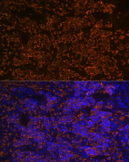 IHC-P analysis of rat spleen tissue section using Hemoglobin alpha [GT1234] Hemoglobin alpha [GT1234]. Dilution : 1:100 Blue : DAPI for nuclear staining.