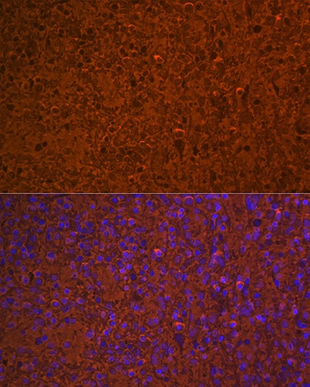IHC-P analysis of human spleen tissue section using Hemoglobin alpha [GT1234] Hemoglobin alpha [GT1234]. Dilution : 1:100 Blue : DAPI for nuclear staining.