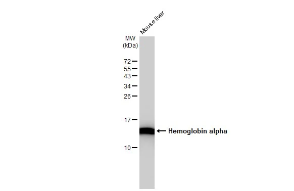Mouse tissue extract (50 microg) was separated by 15% SDS-PAGE, and the membrane was blotted with Hemoglobin alpha [GT1234] (GTX02831) diluted at 1:50000. The HRP-conjugated anti-rabbit IgG antibody (GTX213110-01) was used to detect the primary antibody.