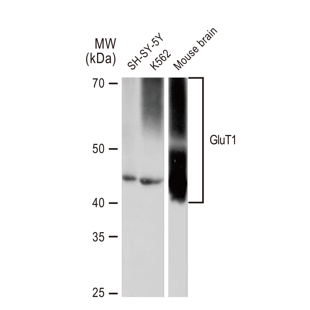 WB analysis of various samples using GTX02832 GluT1 antibody [GT1235]. Dilution : 1:1000 Loading : 25microg