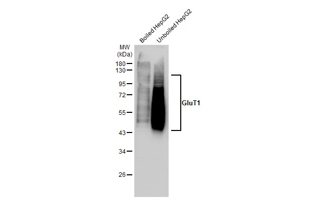 Boiled and unboiled HepG2 whole cell extracts (30 microg) were separated by 10% SDS-PAGE, and the membrane was blotted with GluT1 antibody [GT1235] (GTX02832) diluted at 1:1000. The HRP-conjugated anti-rabbit IgG antibody (GTX213110-01) was used to detect the primary antibody.