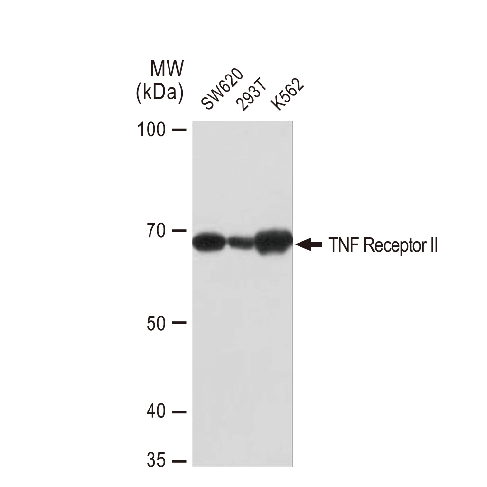 WB analysis of various samples using GTX02834 TNF Receptor II antibody [GT1237]. Dilution : 1:1000 Loading : 25microg