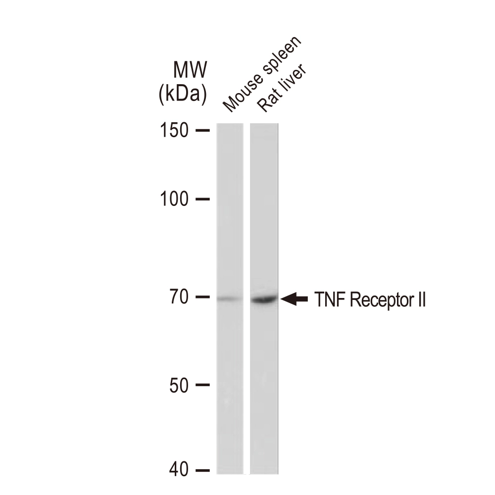 WB analysis of various samples using GTX02834 TNF Receptor II antibody [GT1237]. Dilution : 1:1000 Loading : 25microg