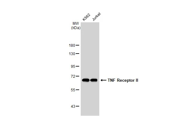 Various whole cell extracts (30 microg) were separated by 7.5% SDS-PAGE, and the membrane was blotted with TNF Receptor II antibody [GT1237] (GTX02834) diluted at 1:1000. The HRP-conjugated anti-rabbit IgG antibody (GTX213110-01) was used to detect the primary antibody.
