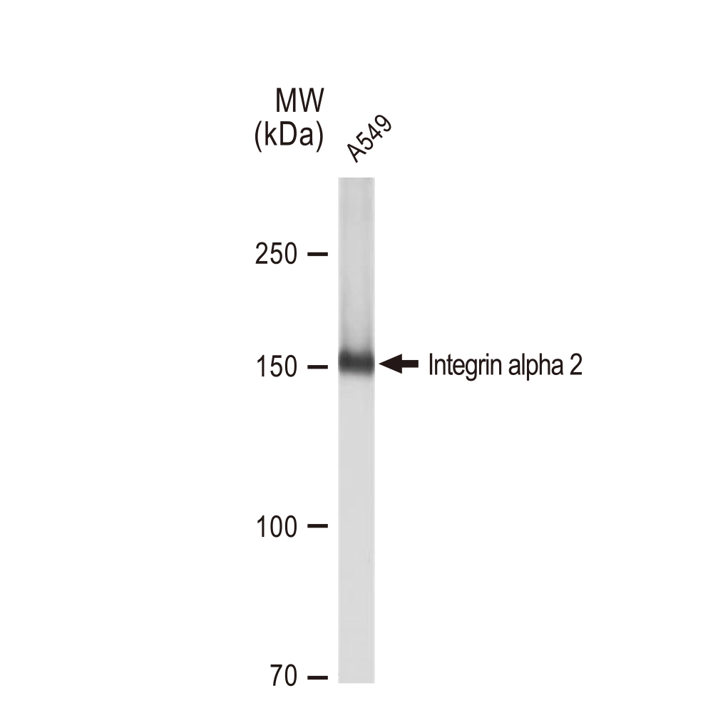 WB analysis of A549 whole cell lysate using GTX02835 Integrin alpha 2 antibody [GT1238]. Dilution : 1:1000 Loading : 25microg