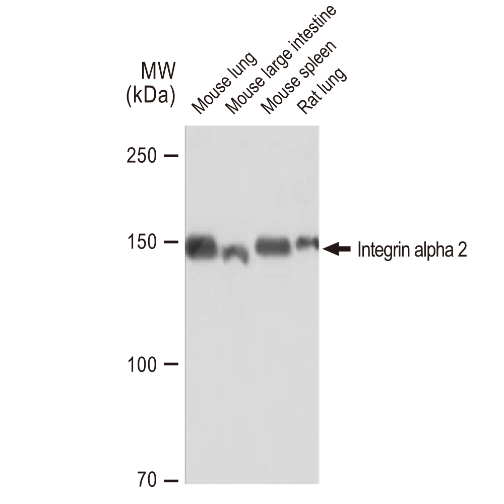 WB analysis of various samples using GTX02835 Integrin alpha 2 antibody [GT1238]. Dilution : 1:1000 Loading : 25microg