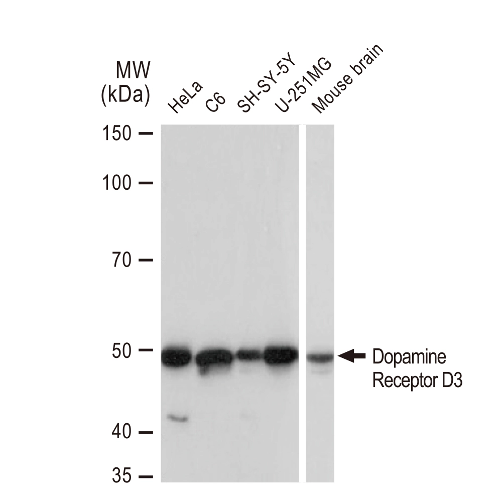 WB analysis of various samples using GTX02836 Dopamine Receptor D3 antibody [GT1239]. Dilution : 1:1000 Loading : 25microg