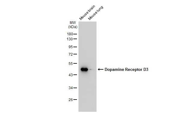 Various tissue extracts (50 microg) were separated by 10% SDS-PAGE, and the membrane was blotted with Dopamine Receptor D3 antibody [GT1239] (GTX02836) diluted at 1:1000. The HRP-conjugated anti-rabbit IgG antibody (GTX213110-01) was used to detect the primary antibody.
