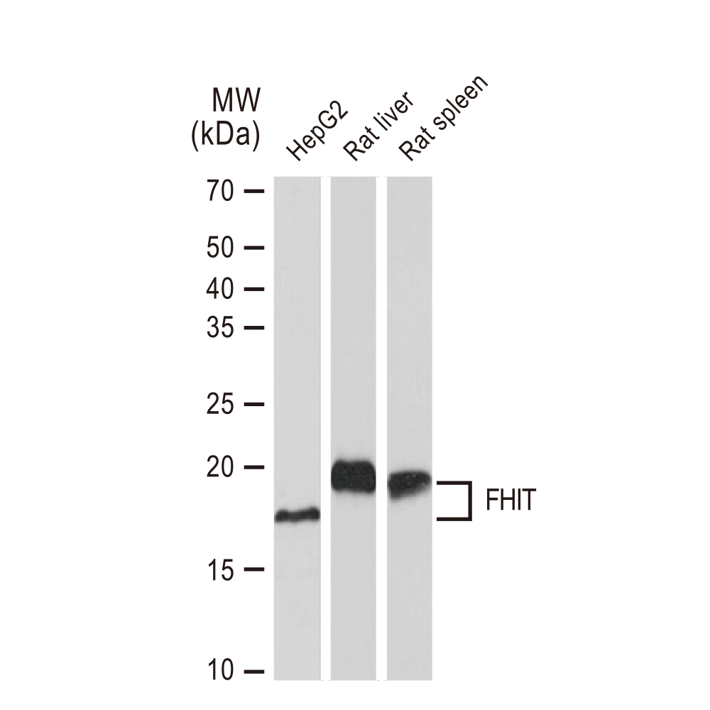 WB analysis of various samples using GTX02837 FHIT antibody [GT1240]. Dilution : 1:1000 Loading : 25microg
