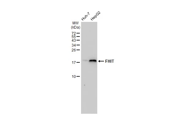 Various whole cell extracts (30 microg) were separated by 15% SDS-PAGE, and the membrane was blotted with FHIT antibody [GT1240] (GTX02837) diluted at 1:1000. The HRP-conjugated anti-rabbit IgG antibody (GTX213110-01) was used to detect the primary antibody.