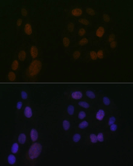 ICC/IF analysis of U2OS cells using GTX02838 5-Lipoxygenase antibody [GT1241]. Dilution : 1:100 Blue : DAPI for nuclear staining.