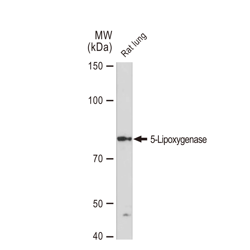 WB analysis of rat lung tissue lysates using GTX02838 5-Lipoxygenase antibody [GT1241]. Dilution : 1:1000 Loading : 25microg