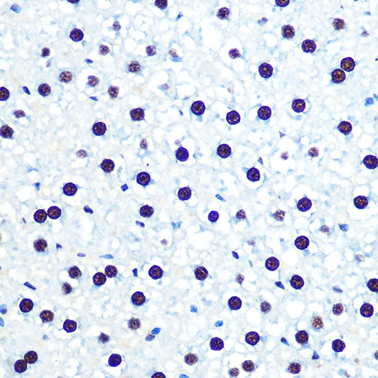 IHC-P analysis of rat liver tissue section using GTX02839 hnRNP U antibody [GT1242]. Dilution : 1:100