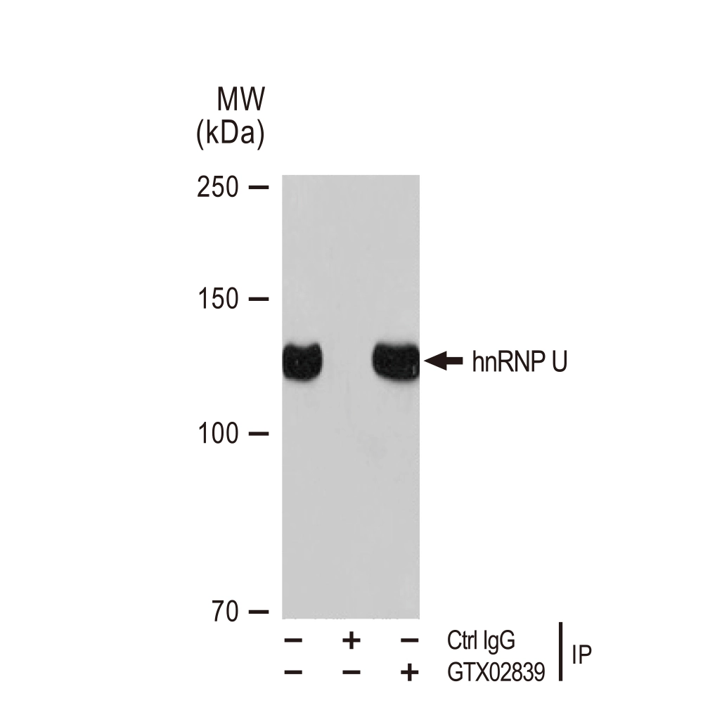 IP analysis of K562 whole cell lysate using GTX02839 hnRNP U antibody [GT1242]. Total extract : 300microg IP antibody amount : 3microg Dilution : 1:1000