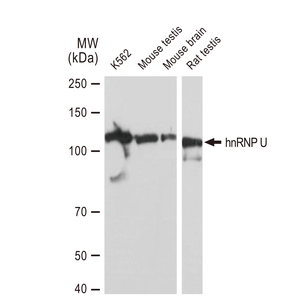 WB analysis of various samples using GTX02839 hnRNP U antibody [GT1242]. Dilution : 1:1000 Loading : 25microg