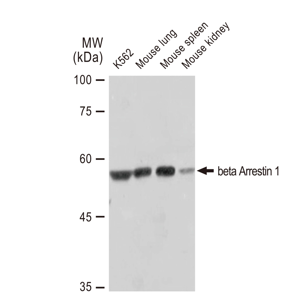 WB analysis of various samples using GTX02840 beta Arrestin 1 antibody [GT1243]. Dilution : 1:1000 Loading : 25microg