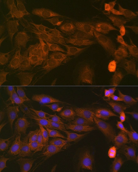 ICC/IF analysis of C6 cells using GTX02841 STAT4 antibody [GT1244]. Dilution : 1:100 Blue : DAPI for nuclear staining.