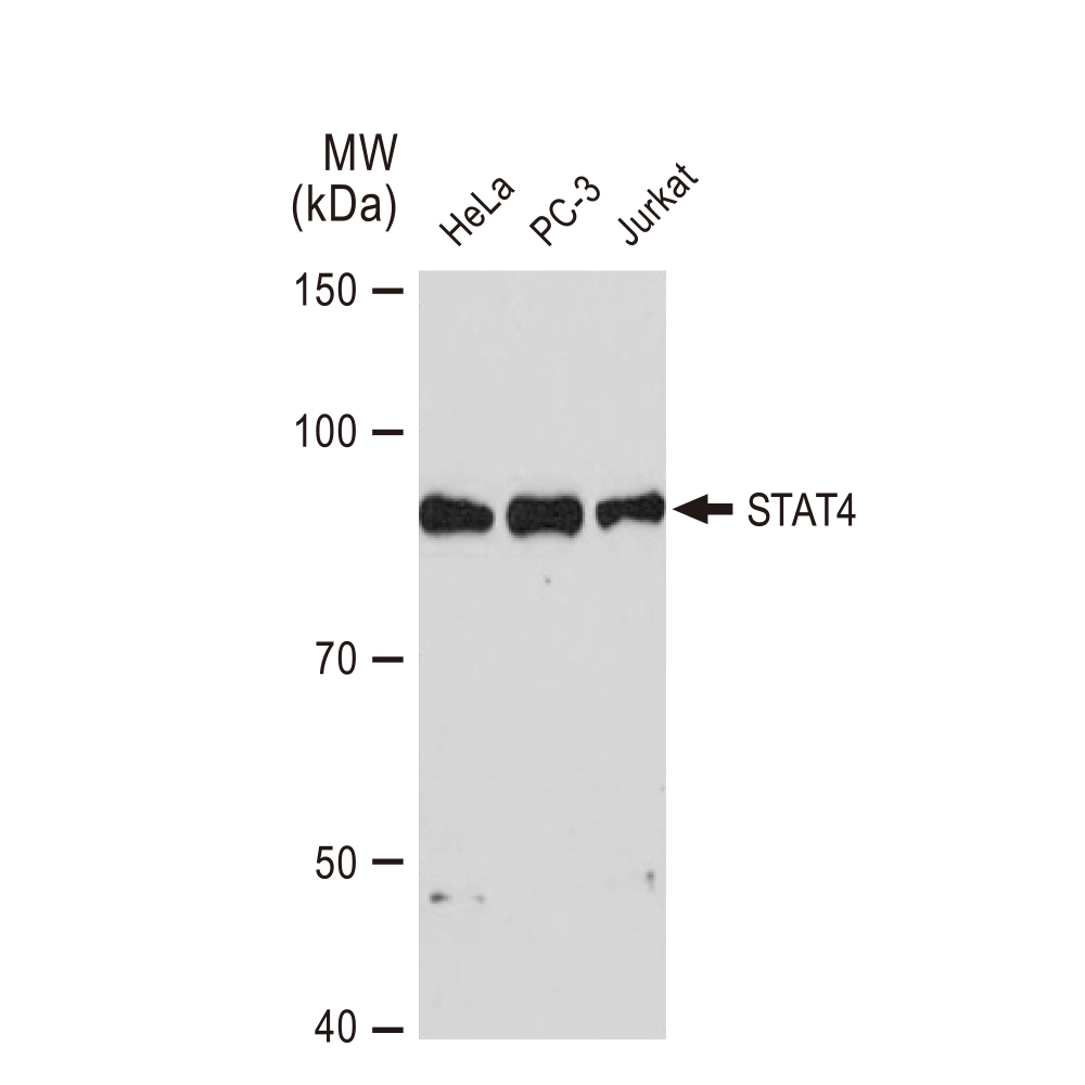 WB analysis of various samples using GTX02841 STAT4 antibody [GT1244]. Dilution : 1:1000 Loading : 25microg