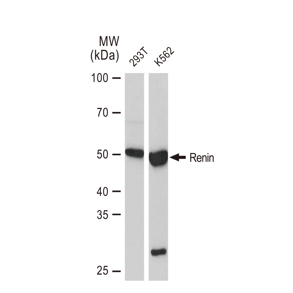 WB analysis of various samples using GTX02842 Renin antibody [GT1245]. Dilution : 1:1000 Loading : 25microg