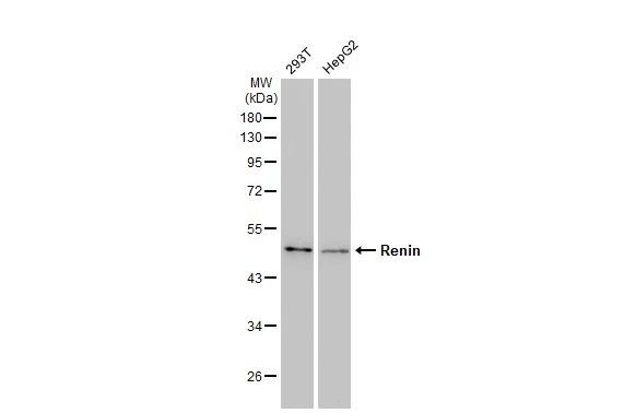 Various whole cell extracts (30 microg) were separated by 10% SDS-PAGE, and the membrane was blotted with Renin antibody [GT1245] (GTX02842) diluted at 1:1000. The HRP-conjugated anti-rabbit IgG antibody (GTX213110-01) was used to detect the primary antibody, and the signal was developed with Trident ECL plus-Enhanced.