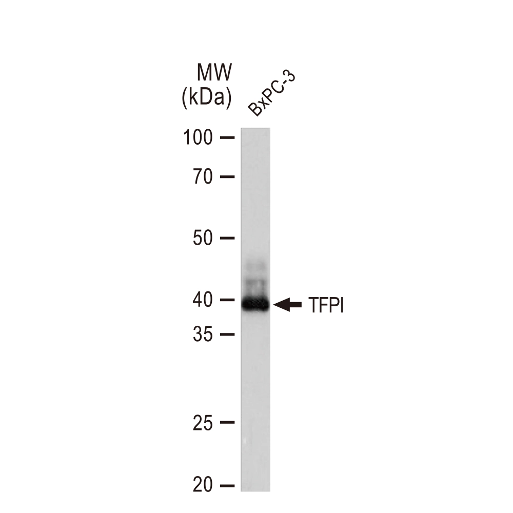 WB analysis of BxPC-3 whole cell lysate using GTX02843 TFPI antibody [GT1246]. Dilution : 1:1000 Loading : 25microg