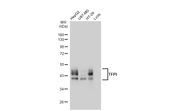 Various whole cell extracts (30 microg) were separated by 10% SDS-PAGE, and the membrane was blotted with TFPI antibody [GT1246] (GTX02843) diluted at 1:1000. The HRP-conjugated anti-rabbit IgG antibody (GTX213110-01) was used to detect the primary antibody.
