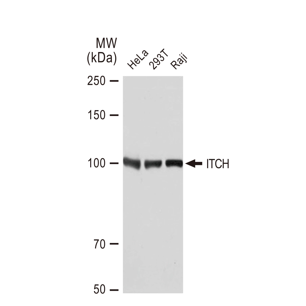 WB analysis of various samples using GTX02845 ITCH antibody [GT1248]. Dilution : 1:1000 Loading : 25microg
