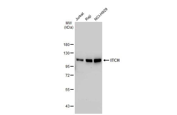 Various whole cell extracts (30 microg) were separated by 7.5% SDS-PAGE, and the membrane was blotted with ITCH antibody [GT1248] (GTX02845) diluted at 1:1000. The HRP-conjugated anti-rabbit IgG antibody (GTX213110-01) was used to detect the primary antibody.