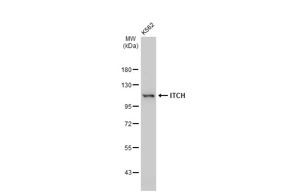 Whole cell extract (30 microg) was separated by 7.5% SDS-PAGE, and the membrane was blotted with ITCH antibody [GT1248] (GTX02845) diluted at 1:1000. The HRP-conjugated anti-rabbit IgG antibody (GTX213110-01) was used to detect the primary antibody.