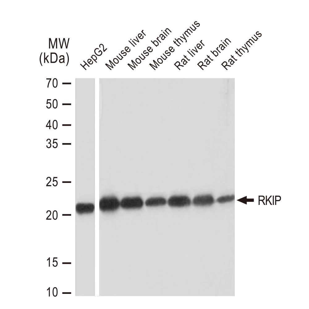 WB analysis of various samples using GTX02846 RKIP antibody [GT1249]. Dilution : 1:1000 Loading : 25microg