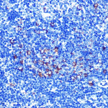 IHC-P analysis of mouse spleen tissue section using GTX02847 C1qBP antibody [GT1250]. Dilution : 1:100