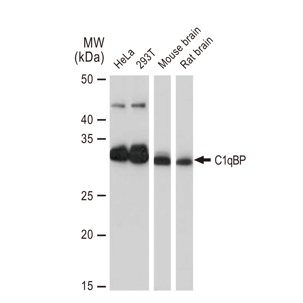 WB analysis of various samples using GTX02847 C1qBP antibody [GT1250]. Dilution : 1:1000 Loading : 25microg