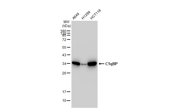 Various whole cell extracts (30 microg) were separated by 12% SDS-PAGE, and the membrane was blotted with C1qBP antibody [GT1250] (GTX02847) diluted at 1:1000. The HRP-conjugated anti-rabbit IgG antibody (GTX213110-01) was used to detect the primary antibody.