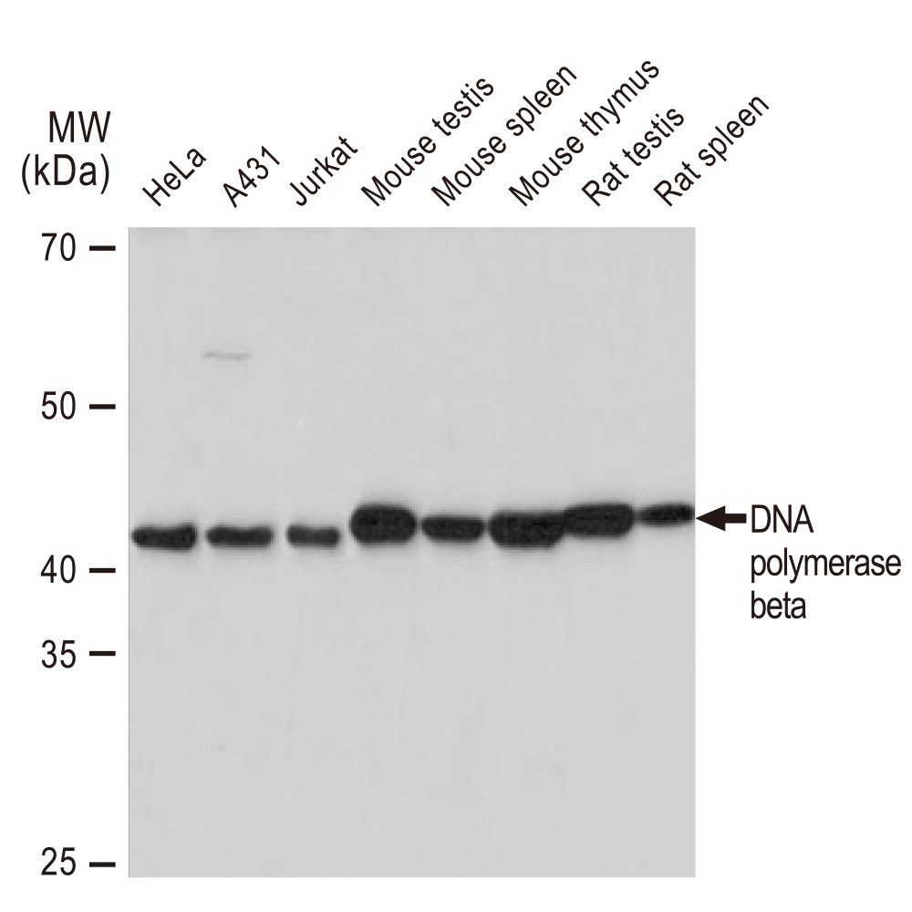 WB analysis of various samples using GTX02848 DNA polymerase beta antibody [GT1251]. Dilution : 1:1000 Loading : 25microg
