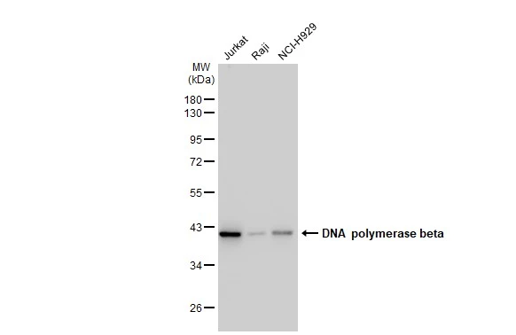 Various whole cell extracts (30 microg) were separated by 10% SDS-PAGE, and the membrane was blotted with DNA polymerase beta antibody [GT1251] (GTX02848) diluted at 1:1000. The HRP-conjugated anti-rabbit IgG antibody (GTX213110-01) was used to detect the primary antibody.