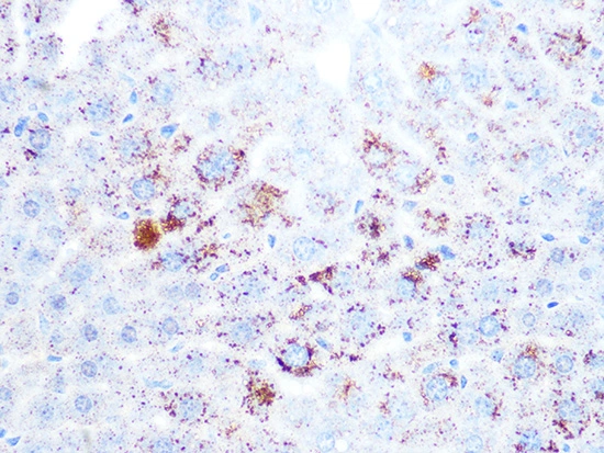 IHC-P analysis of mouse liver tissue section using GTX02849 Cathepsin L/V/K/H antibody [GT1252]. Dilution : 1:100